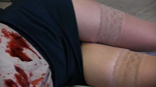 16 04 TES blood & legs.jpg